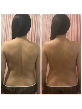 リコ(Relaxation Boutique LICO)/ボディメイキングbefore→after