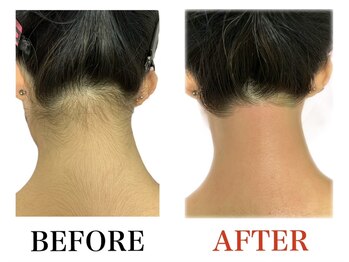 ブリリアンス(BRILLIANCE)/