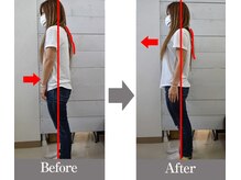 広島横川整体院/ビフォーアフター