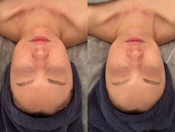 ポーデベロア(Peau des velours)/ハイピールイントゥ