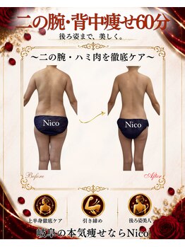 ニコ 岐南本店(Nico)の写真/本気痩せ専門店|二の腕・ハミ肉の根本原因へアプローチ