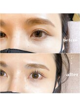 イチマルイチ(&101)/ラッシュリフト