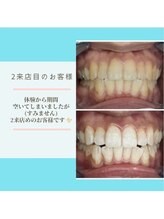 ライトビューティー 本八幡店(LIGHT BEAUTY)/２来店目のお客様♪