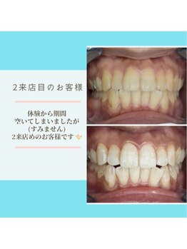 ライトビューティー 本八幡店(LIGHT BEAUTY)/2来店目のお客様♪