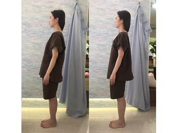 ヒップス(HIPs)/重心施術のビフォーアフター