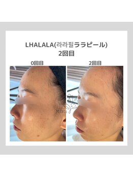 ポムハヌル(pom.haneul)/韓国肌管理室