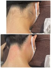 エン(en.)/BeforeAfter写真16