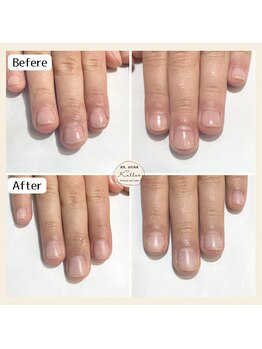 自爪育成　再来