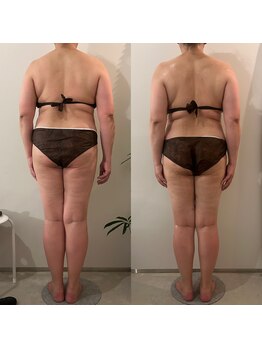 ラナ 京都西院店(Lana)/よもぎ&全身リンパマッサージ