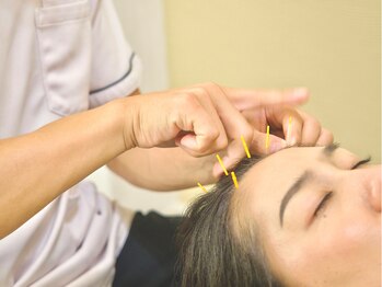 つなぐ/頭皮のリフトアップ