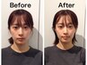 【5周年記念♪】人気No.1メニューが今だけ限定特別価格！【17900→2900】
