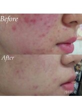 アズール 春日井店(AZURE)/ LED管理