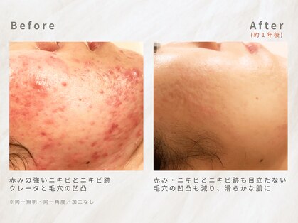 メレ(mele)の写真