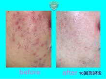 リュクス(LUXE)/ビフォーアフター