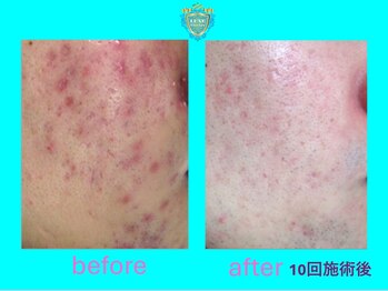 リュクス(LUXE)/ビフォーアフター