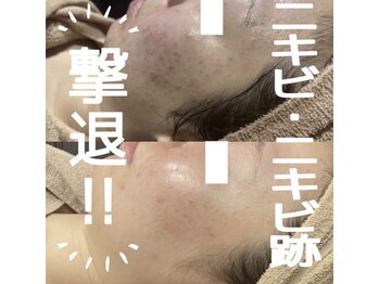 エステティック レイビス 川崎店(RAYVIS)/