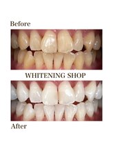 whitening shop 守谷店/ホワイトニングショップ守谷店