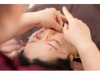 ゆうレディース鍼灸整骨院の写真/【エイジングケア美容鍼】年齢を重ねるごとに気になる、たるみやほうれい線にもアプローチ可能!