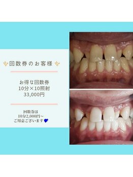 ライトビューティー 本八幡店(LIGHT BEAUTY)/お得な回数券で通った方♪