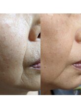 ラトゥール(Latour)/リフトアップ！！