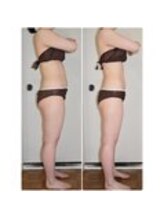 ビューティーワークスシャンティ 柏店(Beauty Works Shanti)/ポッコリお腹×美脚