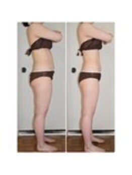 ビューティーワークスシャンティ 柏店(Beauty Works Shanti)/ポッコリお腹×美脚