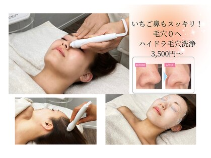 ボニー(BONNY)の写真
