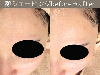 ももとゆでたまご/お顔シェービング/ 新宿渋谷2駅