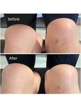 ニコディア(nico-dia)/全身矯正