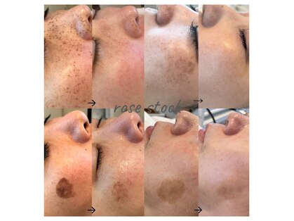 ローズストック(rose stock)の写真