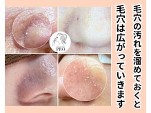 リアン(LIAN)/毛穴改善プレミアムコース