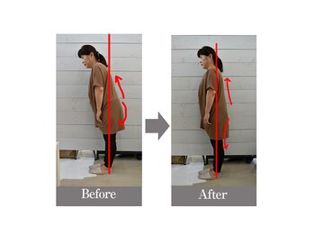 広島横川整体院/ビフォーアフター