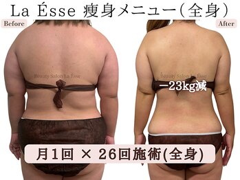 ラエッセ(La Esse)/別人級に変化！