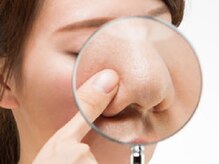 パトラ 三宮店/速攻毛穴ケア★8つのマル秘テク