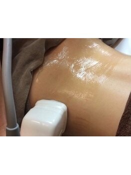 サイズダウンを目指したい