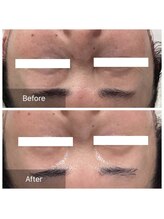 ダリア(Dahlia)/クマ、シワお悩みの方へ