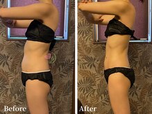 ワールドビューティー(World Beauty)/滝汗デトックス×強圧リンパ痩身