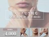 【初回限定】メンズヒゲ脱毛 全8カ所セット(顔全体)1回13,000円→4,000円