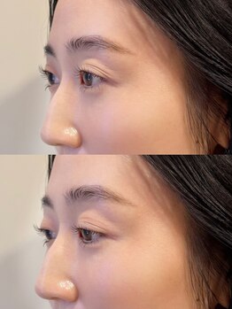 ペネロピ(Penelope)/ラッシュリフト