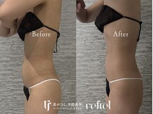 リフィール たまプラーザ店(refiel)/冷え・むくみとおさらば！