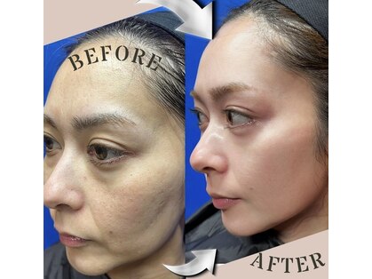 グリッター(GLITTER)の写真