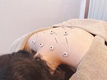 高田馬場はりきゅう院/ストレスへの鍼灸