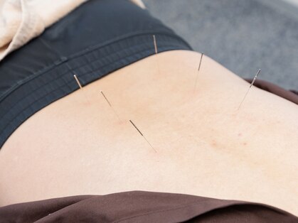 はなみずき鍼灸整骨院 おゆみ野中央院の写真