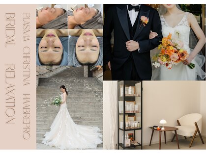 フォセット(fossette)の写真