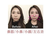 ラプリ 盛岡店(Raplit)の雰囲気（顔と鼻を同時に整えます！盛岡/小顔/小顔矯正）