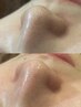 【感謝還元★秋の応援割】毛穴・黒ずみ徹底洗浄 60分