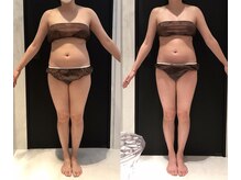 リボディ 表参道(An re Body)/before→after