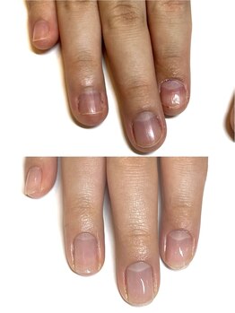 マリーロール 梅田店(Marie Laure)/自爪育成/深爪矯正/ネイルケア