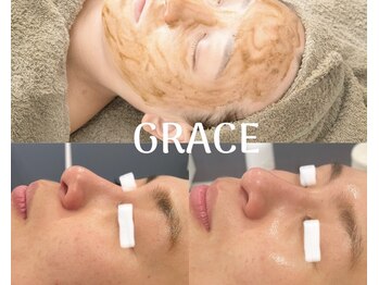 グレース(GRACE)/ツヤ肌!ハーブピーリング