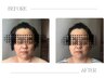 group人気No.１《小顔矯正》美容整体90分【全身骨格矯正×小顔矯正×EMS】